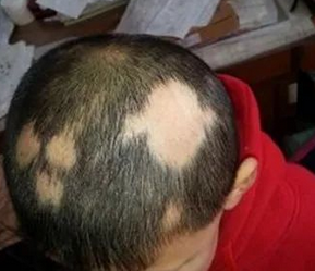 �������и������ʲôԭ�����˰�ͺ�����������ȱ���й�